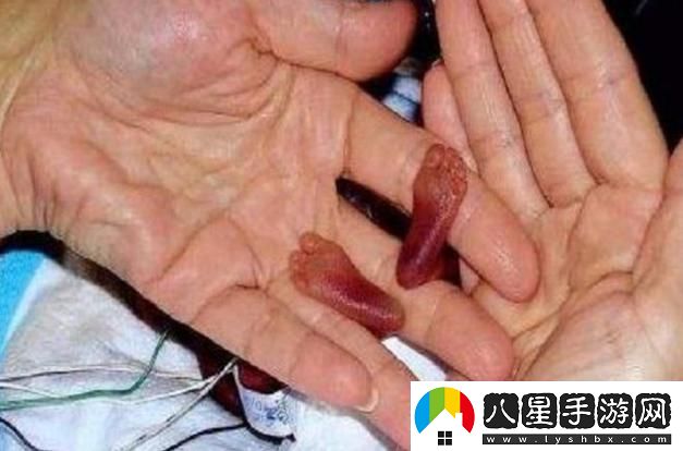 “史上最小BB”爭奪戰